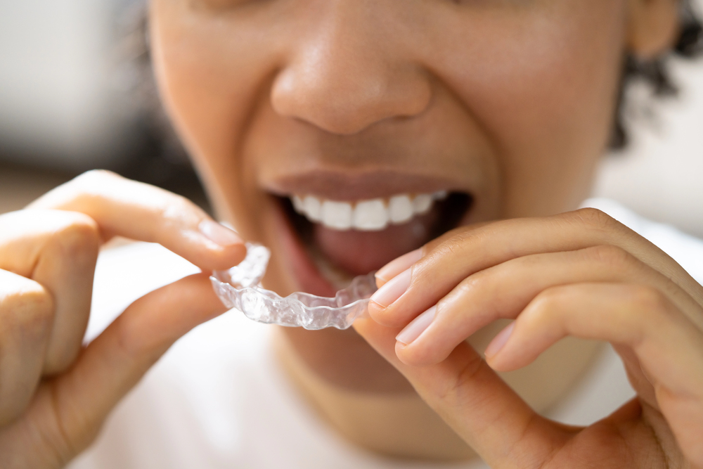 Invisalign